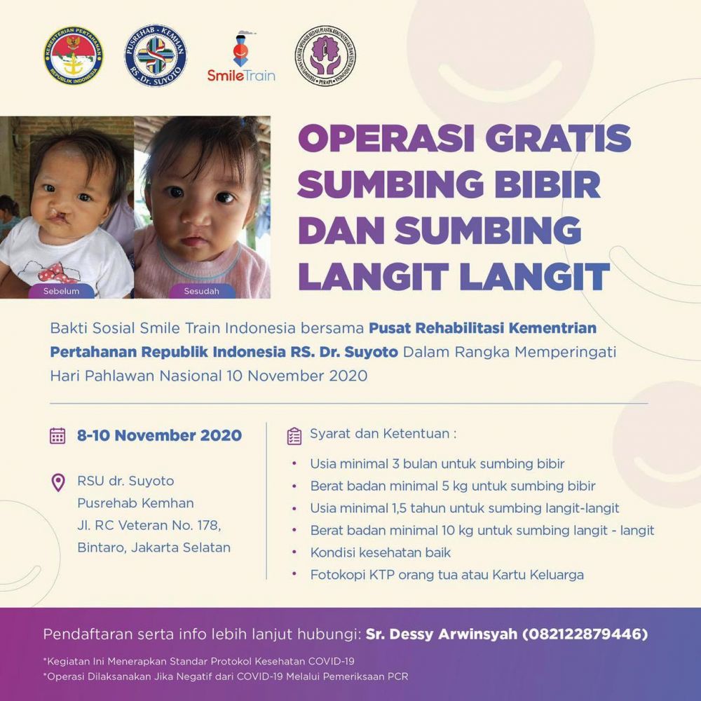 Smile Train Indonesia,Gelar Baksos Operasi Bibir Sumbing
