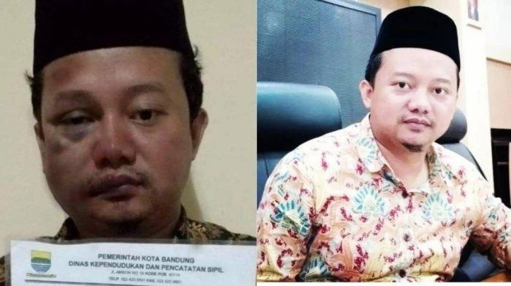 Viral, Wajah Babak Belur Herry Wirawan Pelaku Asusila 12 Santri