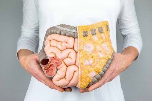 7 Cara Membersihkan Usus Yang Kotor Supaya Sehat, Patut Dicoba Nih..